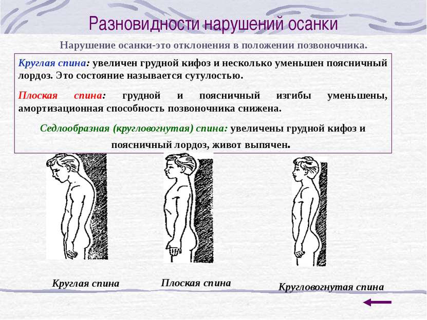 Коррекция осанки Физические упражнения способствуют нормализации осанки. Одна...