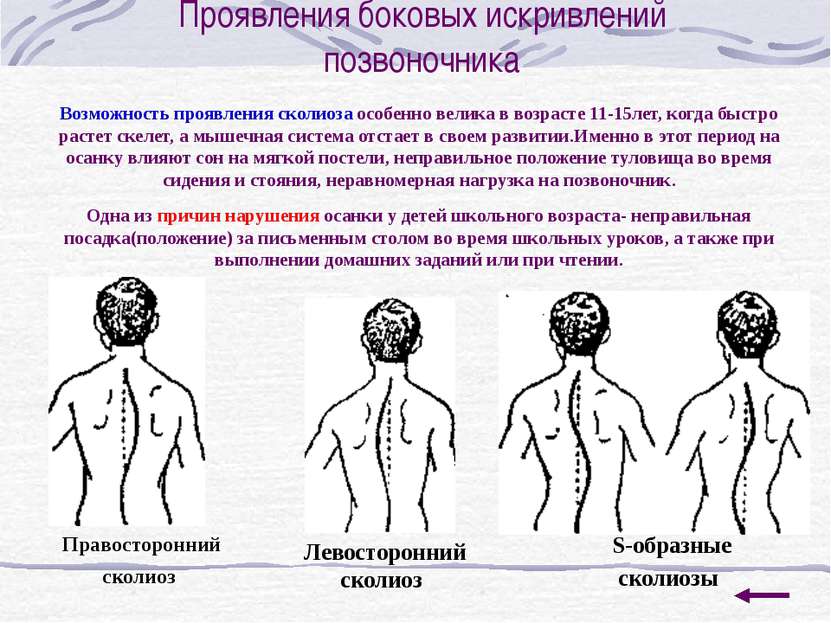 Упражнения для формирования правильной осанки Встать спиной к стене, касаясь ...