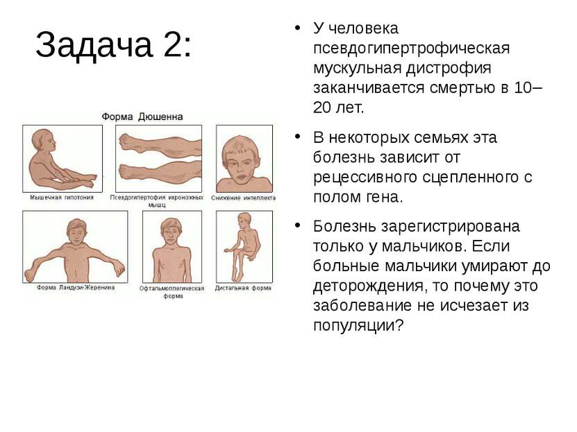Задача 2: У человека псевдогипертрофическая мускульная дистрофия заканчиваетс...