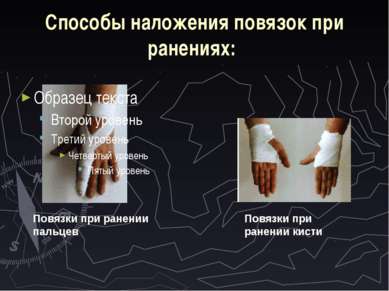 Способы наложения повязок при ранениях: Повязки при ранении пальцев Повязки п...