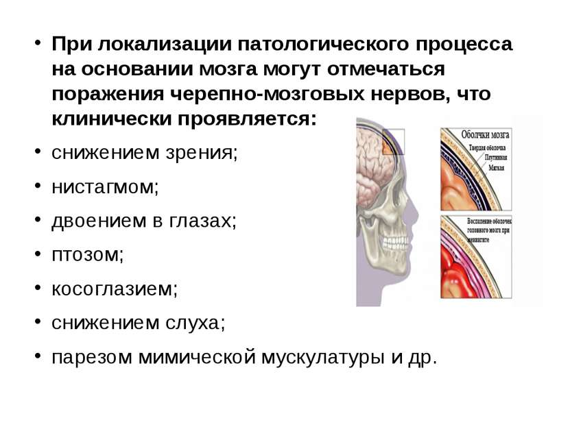 При локализации патологического процесса на основании мозга могут отмечаться ...