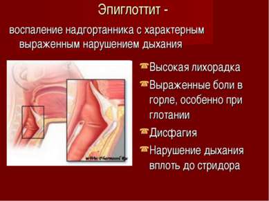 Эпиглоттит - воспаление надгортанника с характерным выраженным нарушением дых...