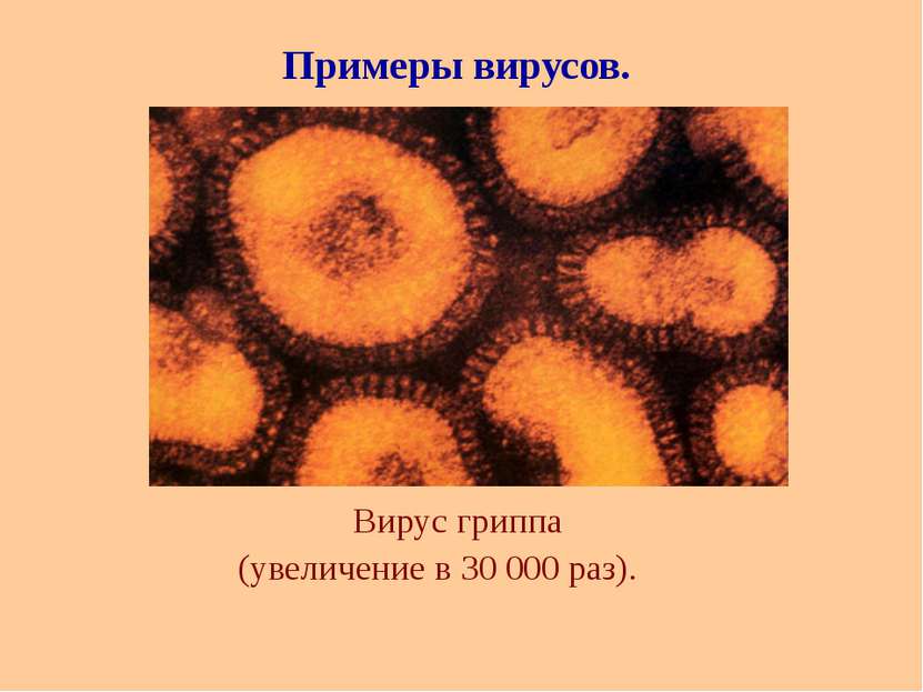 Вирус гриппа (увеличение в 30 000 раз). Примеры вирусов.