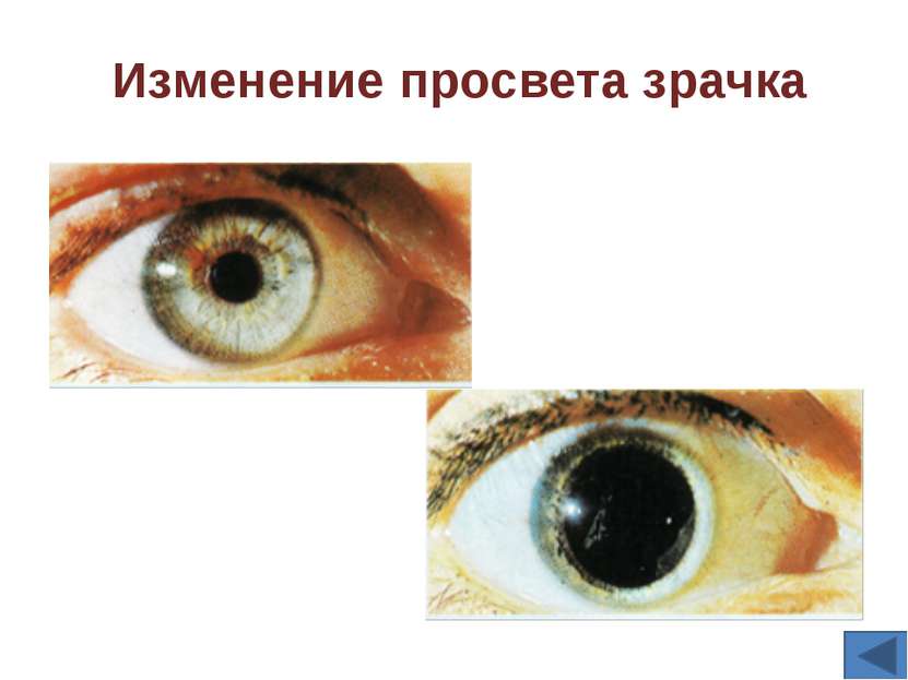 Зрительный анализатор состоит из трех частей: рецепторы сетчатки глаза, зрите...