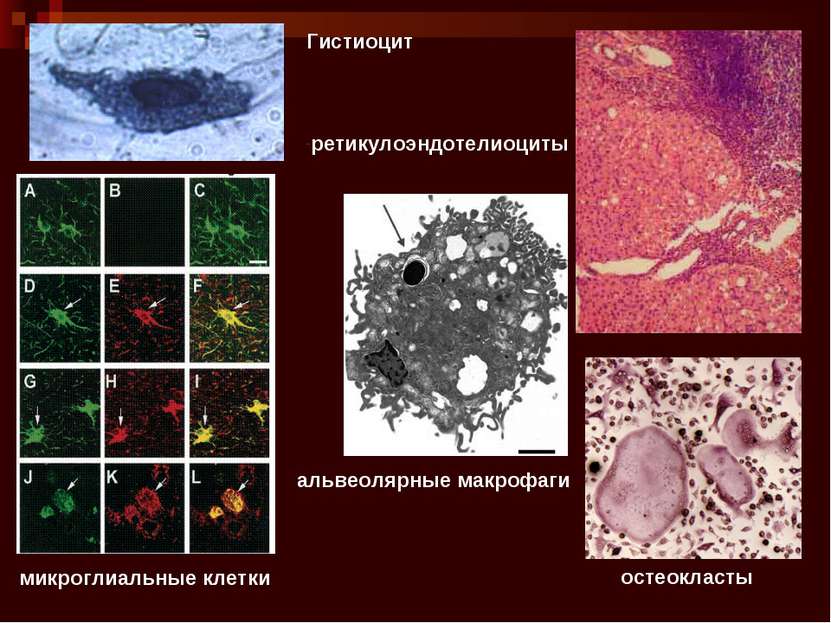 Гистиоцит ретикулоэндотелиоциты альвеолярные макрофаги остеокласты микроглиал...