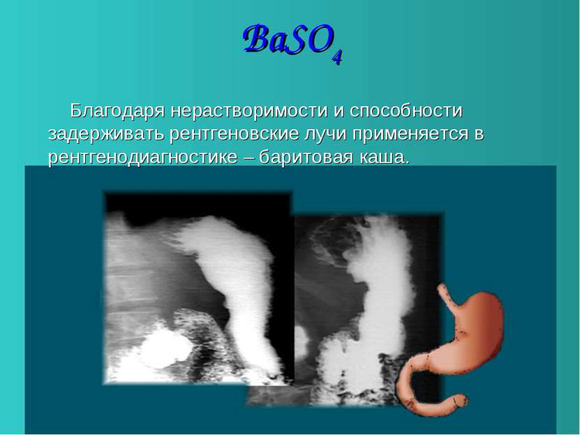 BaSO4 Благодаря нерастворимости и способности задерживать рентгеновские лучи ...