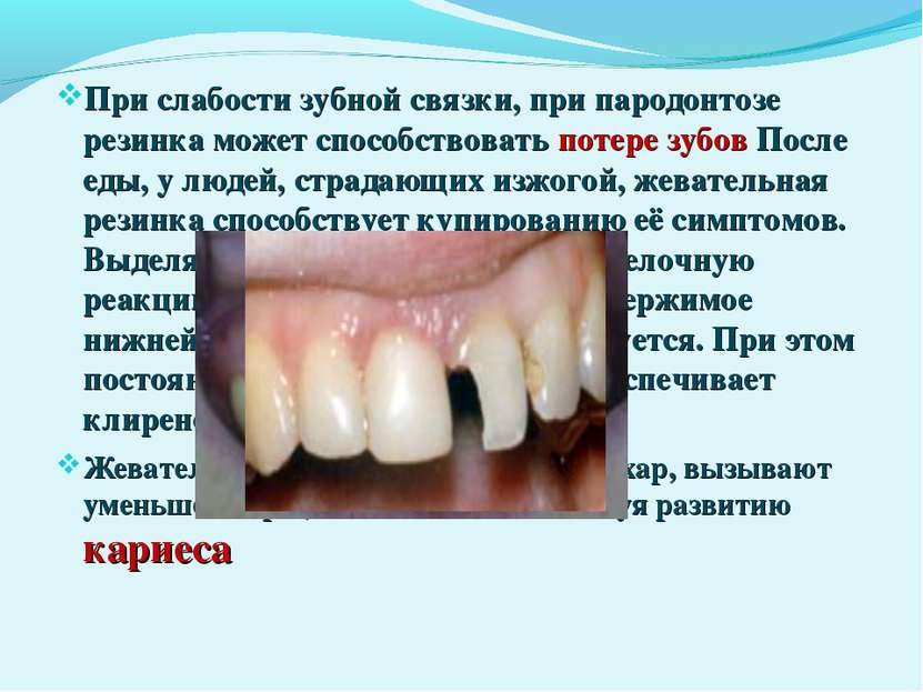При слабости зубной связки, при пародонтозе резинка может способствовать поте...