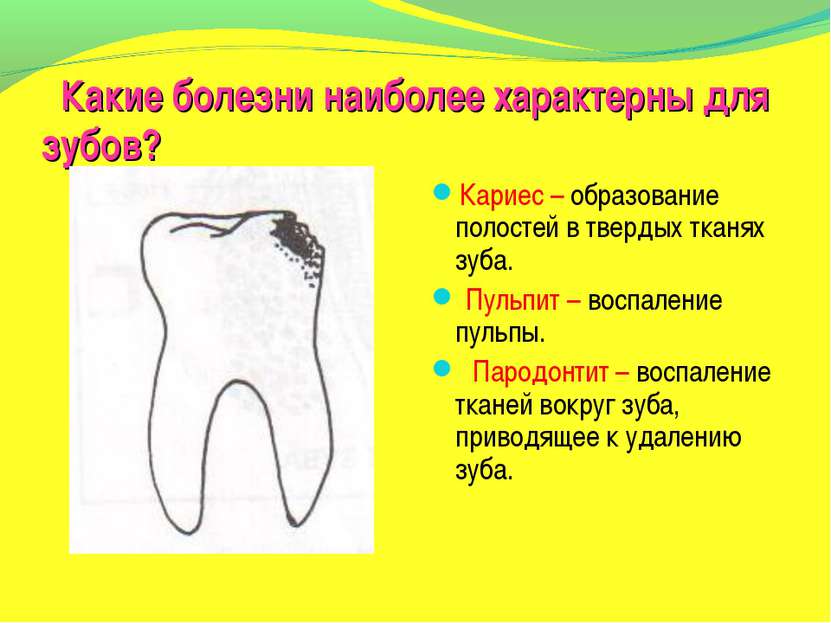 Какие болезни наиболее характерны для зубов? Кариес – образование полостей в ...