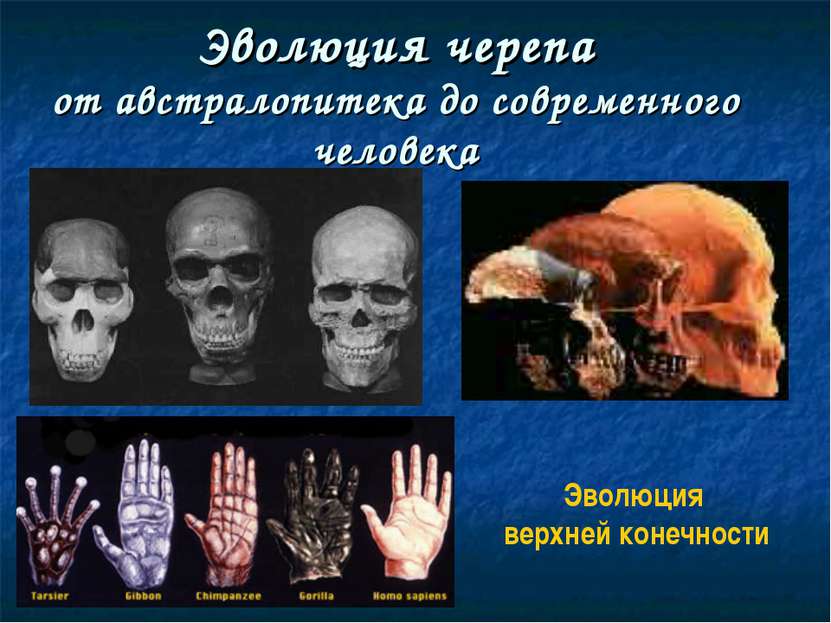 Эволюция черепа от австралопитека до современного человека Эволюция верхней к...