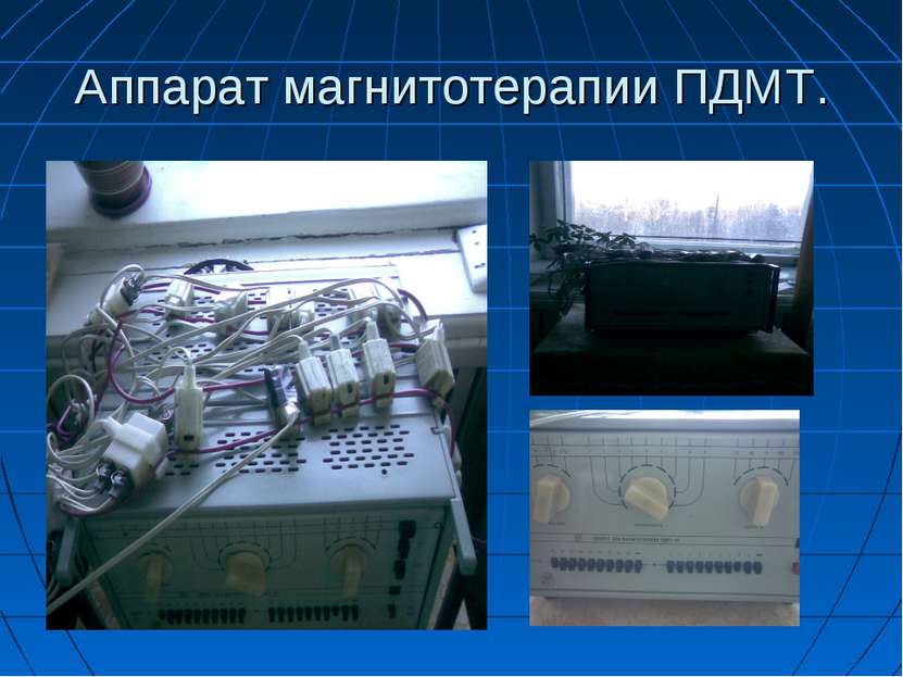 Аппарат магнитотерапии ПДМТ.