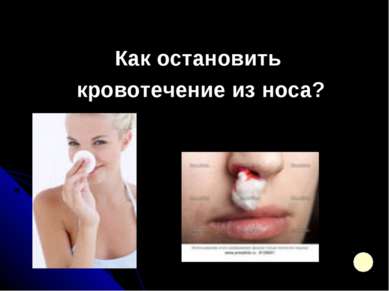 Как остановить кровотечение из носа?