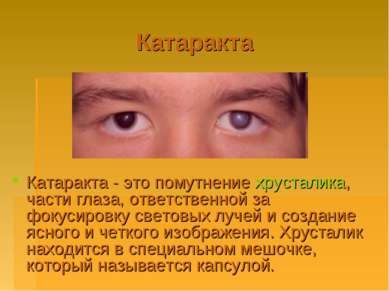 Катаракта Катаракта - это помутнение хрусталика, части глаза, ответственной з...