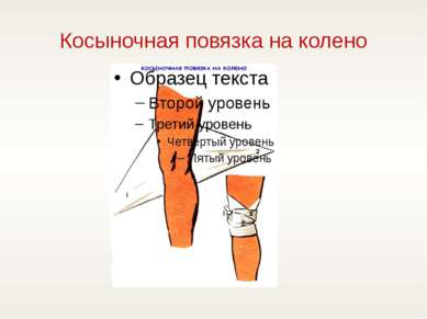 Косыночная повязка на колено