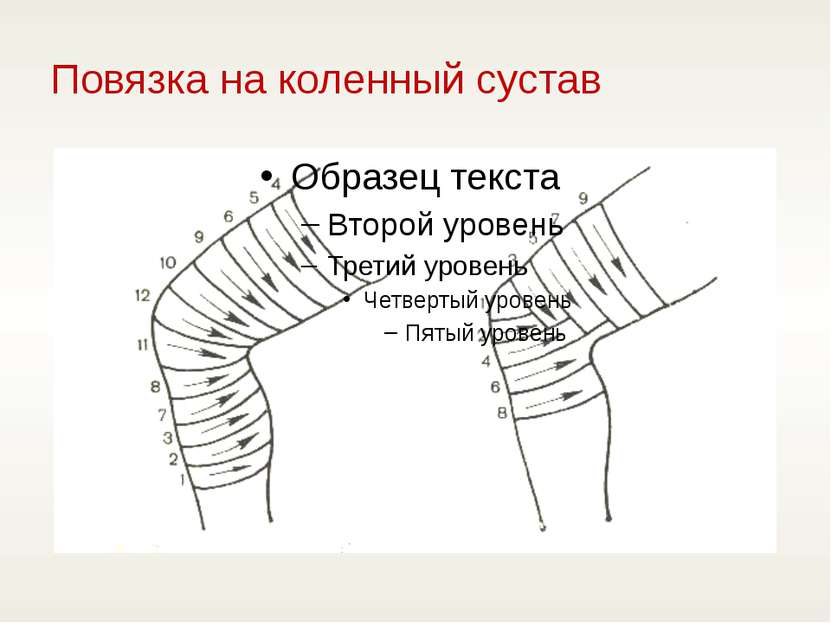 Повязка на коленный сустав