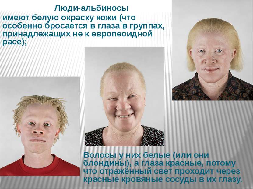 Люди-альбиносы имеют белую окраску кожи (что особенно бросается в глаза в гру...