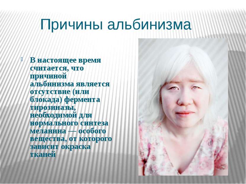 Причины альбинизма В настоящее время считается, что причиной альбинизма являе...