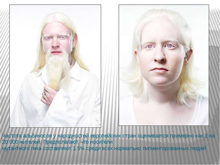 Частота альбиносов у народностей европейских стран оценивается примерно как 1...