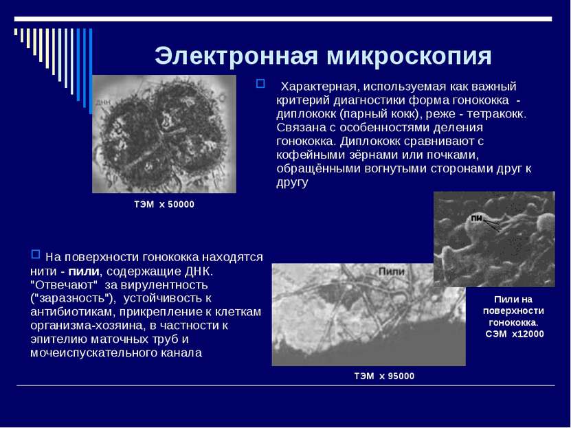 Электронная микроскопия Характерная, используемая как важный критерий диагнос...