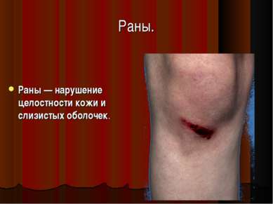 Раны. Раны — нарушение целостности кожи и слизистых оболочек.