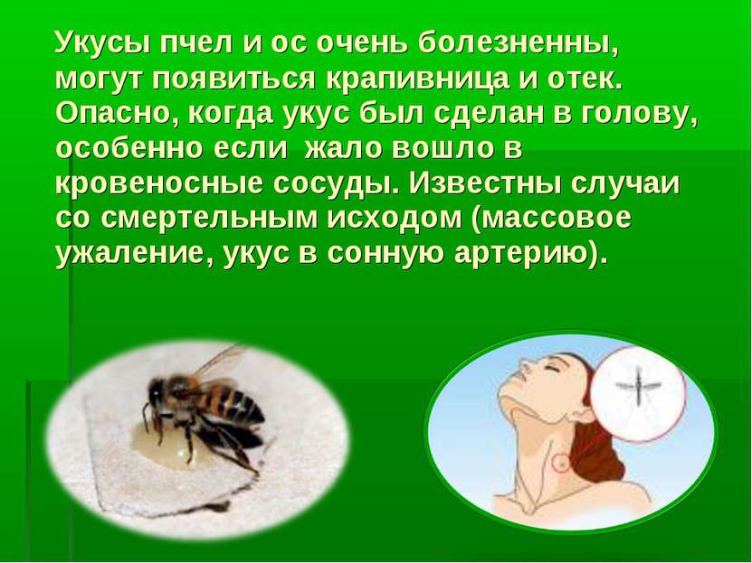 Укусы пчел и ос очень болезненны, могут появиться крапивница и отек. Опасно, ...