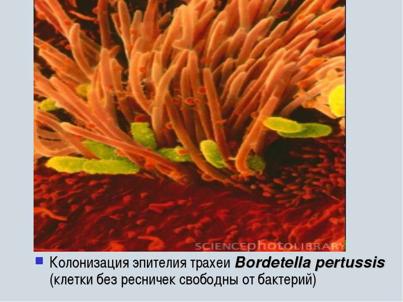 Колонизация эпителия трахеи Bordetella pertussis (клетки без ресничек свободн...