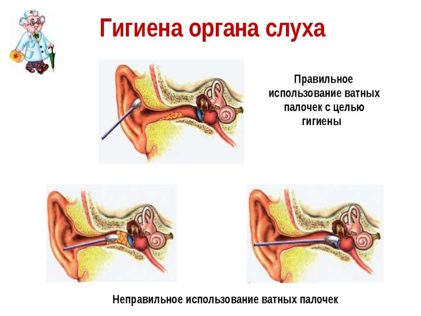 Гигиена органа слуха Правильное использование ватных палочек с целью гигиены ...