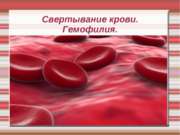 Свертывание крови. Гемофилия