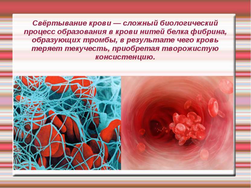 Свёртывание крови — сложный биологический процесс образования в крови нитей б...