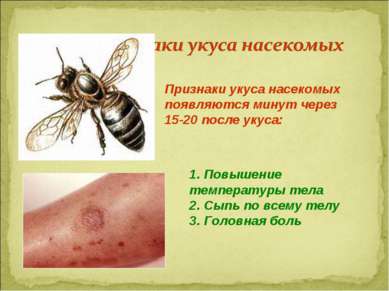 Признаки укуса насекомых появляются минут через 15-20 после укуса: 1. Повышен...