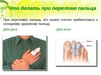 Что делать при переломе пальца При переломах пальца, его нужно плотно прибинт...