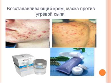Восстанавливающий крем, маска против угревой сыпи http://www.moi-roditeli.ru/...