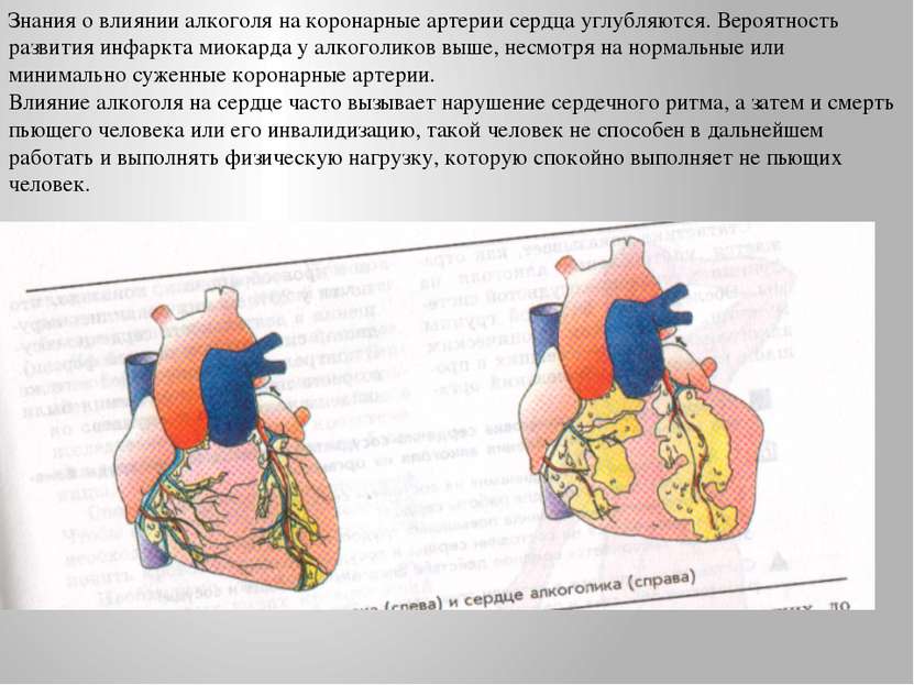 Знания о влиянии алкоголя на коронарные артерии сердца углубляются. Вероятнос...