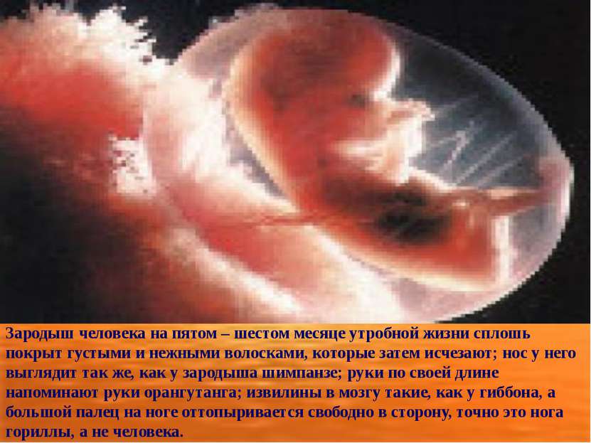 Зародыш человека на пятом – шестом месяце утробной жизни сплошь покрыт густым...