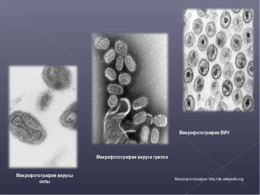 Микрофотография вируса гриппа Микрофотография ВИЧ Микрофотографии: http://de....