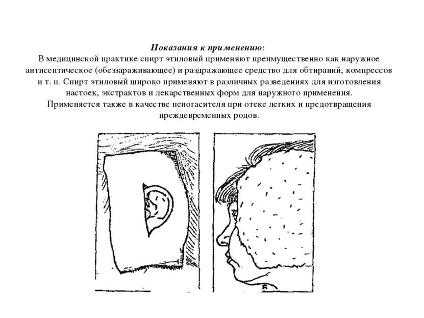 Показания к применению:  В медицинской практике спирт этиловый применяют преи...