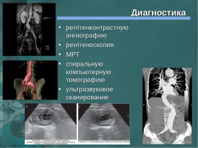 Диагностика рентгенконтрастную ангиографию рентгеноскопия МРТ спиральную комп...