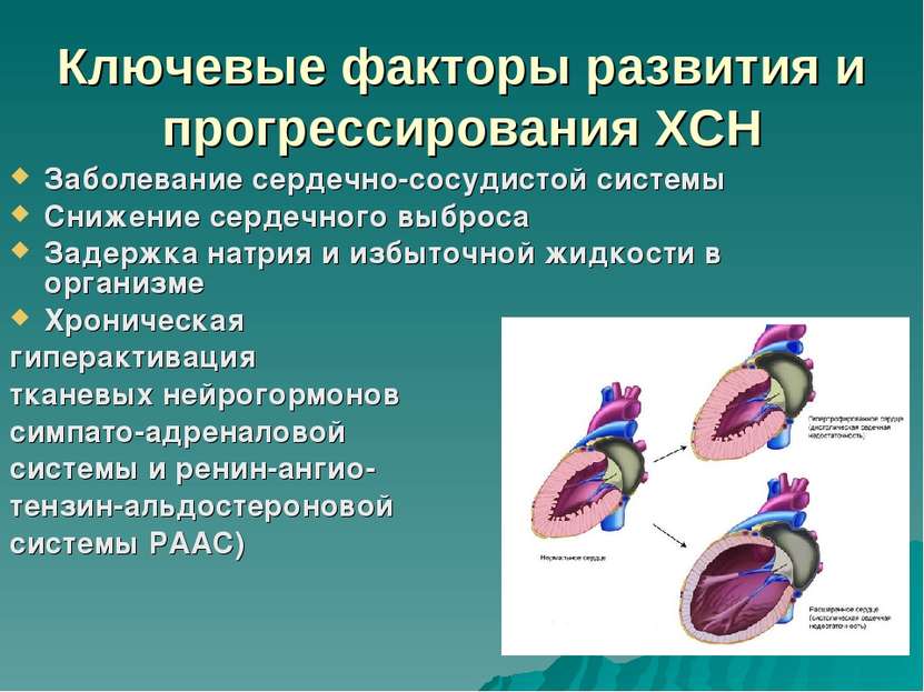 Ключевые факторы развития и прогрессирования ХСН Заболевание сердечно-сосудис...