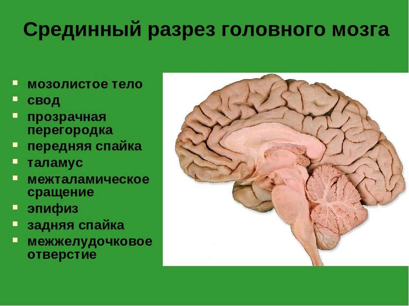 Срединный разрез головного мозга мозолистое тело свод прозрачная перегородка ...