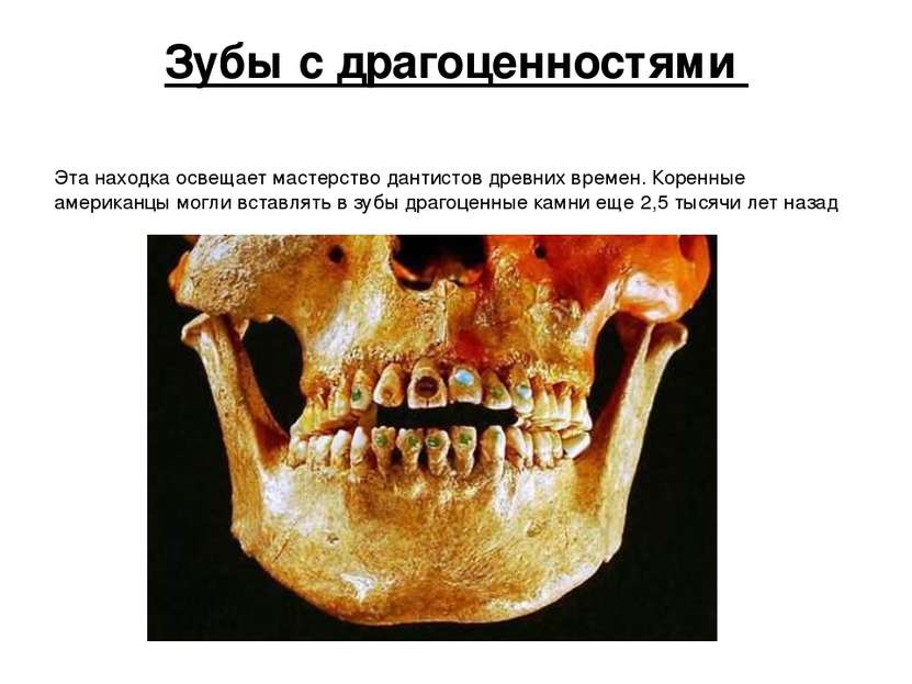 Зубы с драгоценностями Эта находка освещает мастерство дантистов древних врем...