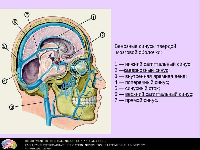 Венозные синусы твердой мозговой оболочки: 1 — нижний сагиттальный синус; 2 —...