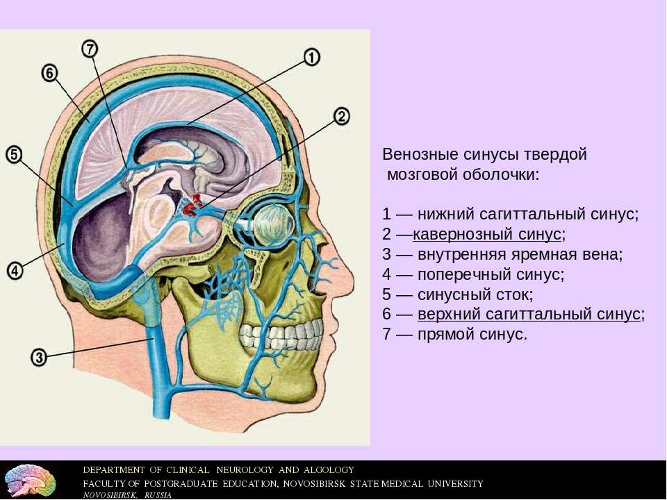 Венозный синус это. Нижний Сагиттальный синус твердой мозговой оболочки. Верхний Сагиттальный синус твердой мозговой оболочки. Венозные пазухи твердой мозговой оболочки анатомия. Верхний и Нижний Сагиттальный синус.