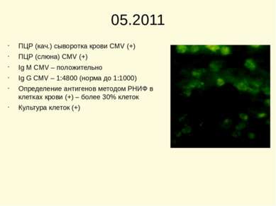 05.2011 ПЦР (кач.) сыворотка крови CMV (+) ПЦР (слюна) CMV (+) Ig M CMV – пол...