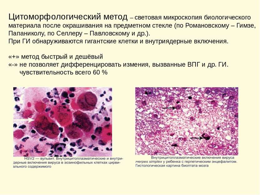 Цитоморфологический метод – световая микроскопия биологического материала пос...