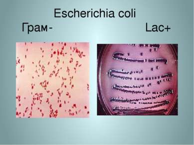 Escherichia coli Грам- Lac+