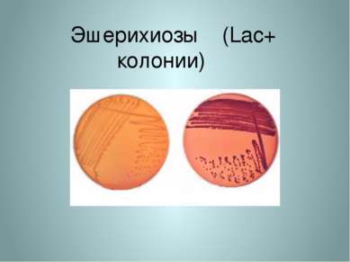 Эшерихиозы (Lac+ колонии)