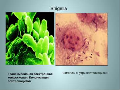 Shigella Трансмиссивная электронная микроскопия. Колонизация эпителиоцитов Ши...