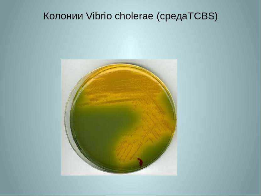Колонии Vibrio cholerae (средаTCBS)