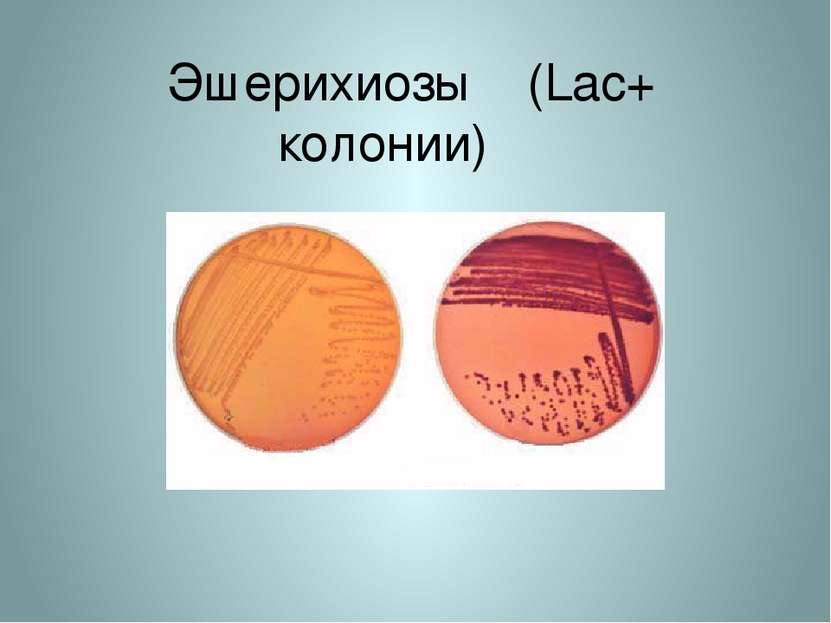 Эшерихиозы (Lac+ колонии)