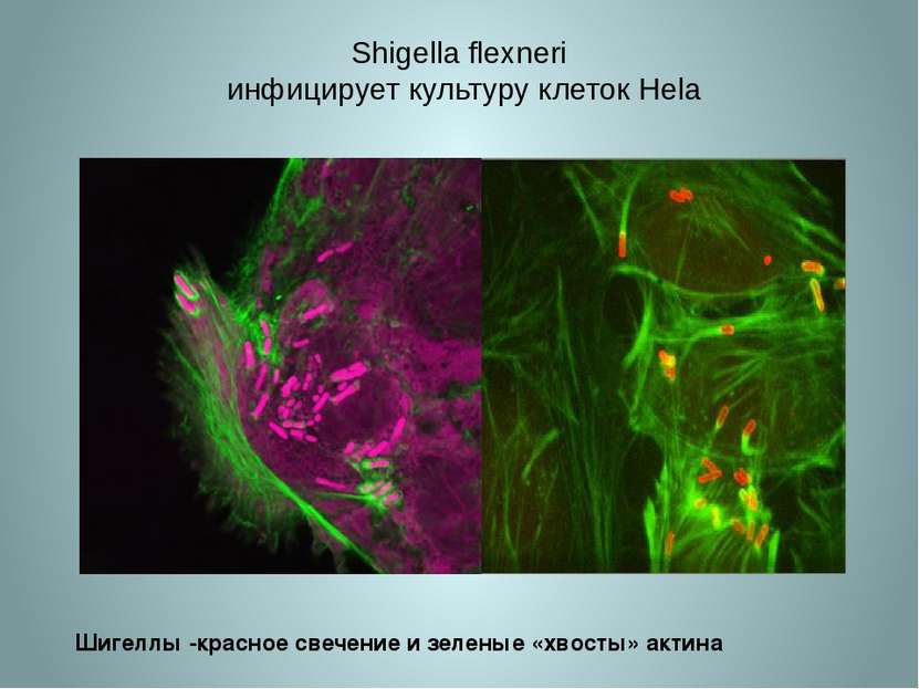 Shigella flexneri инфицирует культуру клеток Hela Шигеллы -красное свечение и...