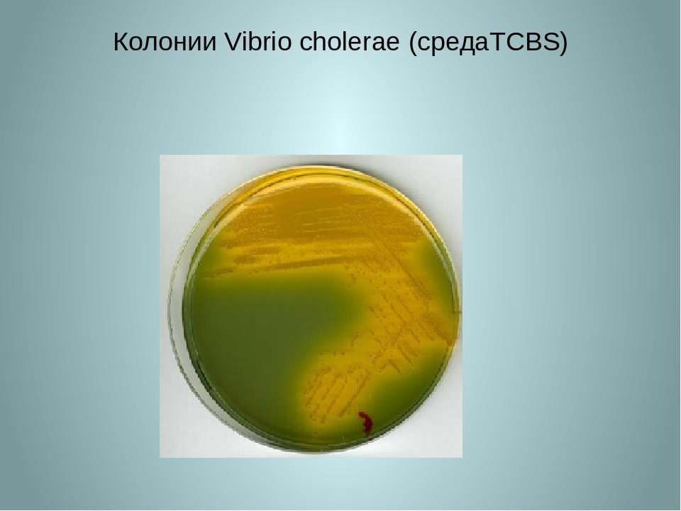 Холера ботулизм. Холерный вибрион на чашке Петри. Vibrio cholerae микробиология. TCBS агар холерный вибрион. Колонии холерного вибриона на щелочном агаре.